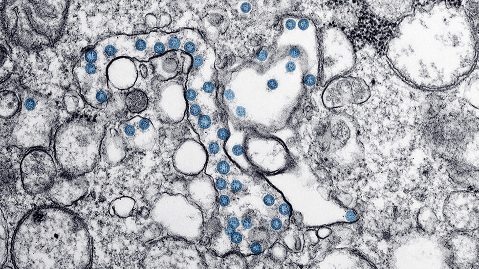 Coronavirus Resources